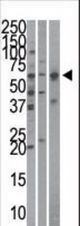 The anti-Importin alpha-3 antibody is used in Western blot to detect Importin alpha-3 in HeLa (left), mouse brain (middle), and HepG2 (right)cell line/tissue lysates.