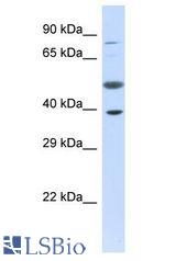 PRR11 antibody Western Blot of Fetal Liver. Antibody dilution: 1 ug/ml.