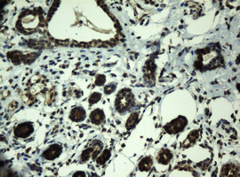 IHC of paraffin-embedded Human breast tissue using anti-PRR11 mouse monoclonal antibody.