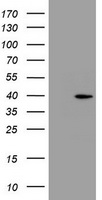 HEK293T cells were transfected with the pCMV6-ENTRY control (Left lane) or pCMV6-ENTRY PRR11 (Right lane) cDNA for 48 hrs and lysed. Equivalent amounts of cell lysates (5 ug per lane) were separated by SDS-PAGE and immunoblotted with anti-PRR11.
