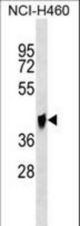 QPCTL Antibody western blot of NCI-H460 cell line lysates (35 ug/lane). The QPCTL antibody detected the QPCTL protein (arrow).