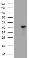 HEK293T cells were transfected with the pCMV6-ENTRY control (Left lane) or pCMV6-ENTRY PRR11 (Right lane) cDNA for 48 hrs and lysed. Equivalent amounts of cell lysates (5 ug per lane) were separated by SDS-PAGE and immunoblotted with anti-PRR11.