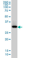 QPRT monoclonal antibody (M01), clone 5D11 Western blot of QPRT expression in HepG2.