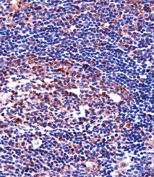 QPRT Antibody immunohistochemistry of formalin-fixed and paraffin-embedded human tonsil tissue followed by peroxidase-conjugated secondary antibody and DAB staining.