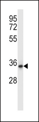 QPRT Antibody western blot of human placenta tissue lysates (35 ug/lane). The QPRT antibody detected the QPRT protein (arrow).