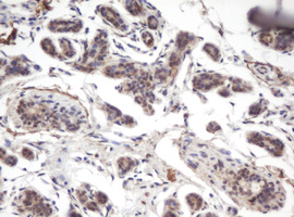 IHC of paraffin-embedded Human breast tissue using anti-PRR11 mouse monoclonal antibody. (Heat-induced epitope retrieval by 10mM citric buffer, pH6.0, 100C for 10min).