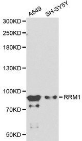 Western blot of RRM1 pAb in extracts from A549 and SH-SY5Y cells.