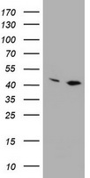 HEK293T cells were transfected with the pCMV6-ENTRY control (Left lane) or pCMV6-ENTRY PRR11 (Right lane) cDNA for 48 hrs and lysed. Equivalent amounts of cell lysates (5 ug per lane) were separated by SDS-PAGE and immunoblotted with anti-PRR11.