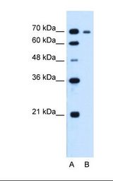 Lane A: Marker. Lane B: HepG2 cell lysate. Antibody concentration: 1.25 ug/ml. Gel concentration: 12%.