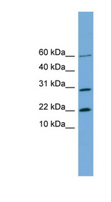 PRR13 antibody LS-C116668 Western blot of HeLa lysate.