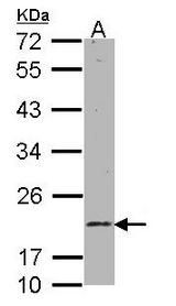 Sample (30 ug of whole cell lysate). A: 293T. 12% SDS PAGE. RAB11A antibody diluted at 1:1000.