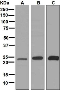 Western blot analysis on (A) PC-12, (B) HeLa, and (C) A549 cell lysates using anti-RAB11A antibody.