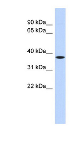 PRR14L / C22orf30 antibody LS-C111672 Western blot of HeLa lysate.