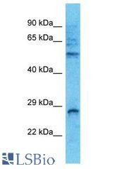 RAB14 antibody Western Blot of THP-1. Antibody dilution: 1 ug/ml.