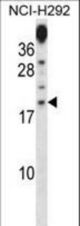 PRR15 Antibody western blot of NCI-H292 cell line lysates (35 ug/lane). The PRR15 antibody detected the PRR15 protein (arrow).