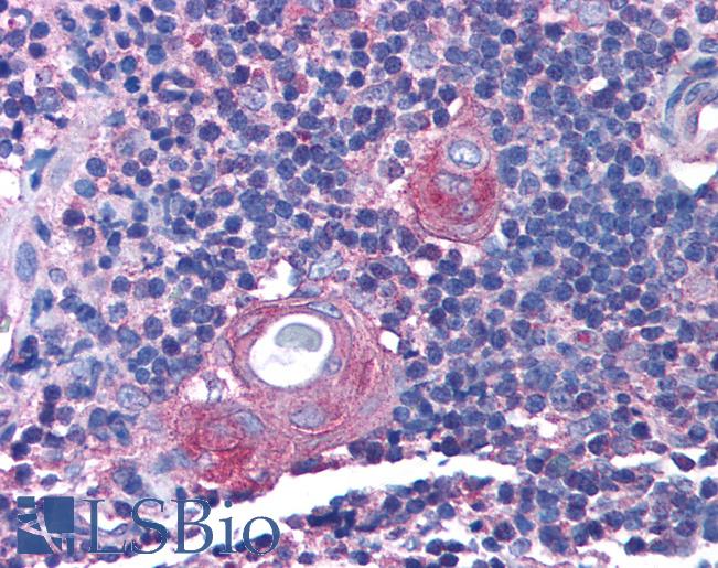 Anti-RAB14 antibody IHC of human thymus. Immunohistochemistry of formalin-fixed, paraffin-embedded tissue after heat-induced antigen retrieval. Antibody LS-B995 concentration 5 ug/ml.