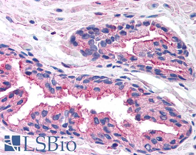 Anti-RAB14 antibody IHC of human prostate. Immunohistochemistry of formalin-fixed, paraffin-embedded tissue after heat-induced antigen retrieval. Antibody LS-B995 concentration 5 ug/ml.