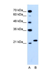 RAB14 antibody LS-B995 Western blot of HepG2 Cell lysate. Antibody concentration 1 ug/ml.