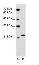 A: Marker, HepG2 Cell Lysate
