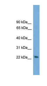 RAB15 antibody LS-C117186 Western blot of Placenta lysate.