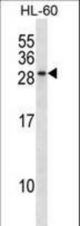 RAB15 Antibody western blot of HL-60 cell line lysates (35 ug/lane). The RAB15 antibody detected the RAB15 protein (arrow).