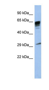 PRR18 antibody LS-C102688 Western blot of Placenta lysate.
