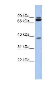 PRR19 antibody LS-C111753 Western blot of Fetal Heart lysate.