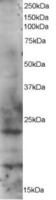 Antibody staining (1 ug/ml) of HeLa lysate (RIPA buffer, 35 ug total protein per lane). Primary incubated for 1 hour. Detected by Western blot of chemiluminescence.