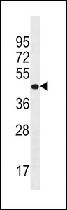 PRR25 Antibody western blot of Uterus tissue lysates (35 ug/lane). The PRR25 antibody detected the PRR25 protein (arrow).