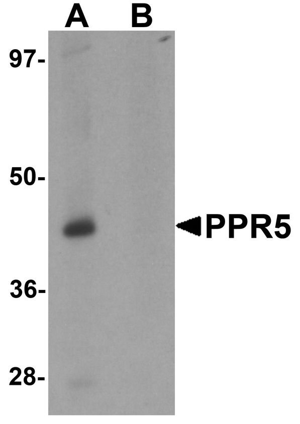 Western blot analysis of PRR5 in SK-N-SH cell lysate with PRR5 antibody at 1 ug/ml in (A) the absence and (B) the presence of blocking peptide