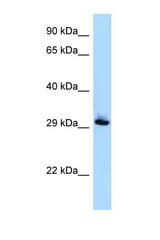 RAB33B antibody LS-C145988 Western blot of Jurkat Cell lysate. Antibody concentration 1 ug/ml.