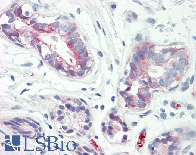 Anti-RAB34 antibody IHC of human breast. Immunohistochemistry of formalin-fixed, paraffin-embedded tissue after heat-induced antigen retrieval. Antibody LS-B8585 dilution 5 ug/ml.