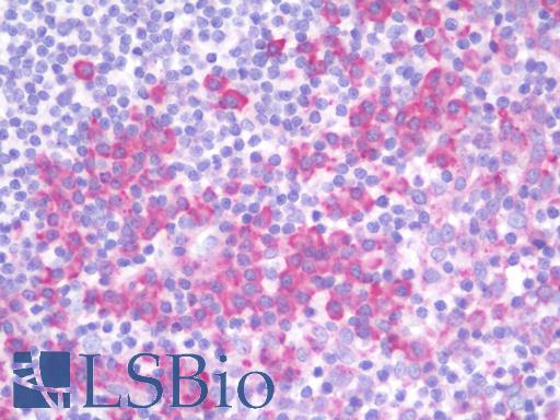 Anti-RAB38 antibody IHC staining of human tonsil. Immunohistochemistry of formalin-fixed, paraffin-embedded tissue after heat-induced antigen retrieval. Antibody LS-B9862 concentration 10 ug/ml.