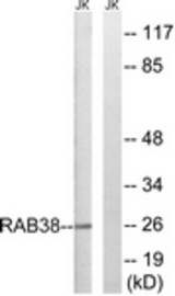 Western blot of extracts from Jurkat cells, using RAB38 Antibody. The lane on the right is treated with the synthesized peptide.