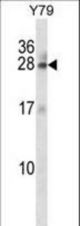 RAB3A Antibody western blot of Y79 cell line lysates (35 ug/lane). The RAB3A antibody detected the RAB3A protein (arrow).