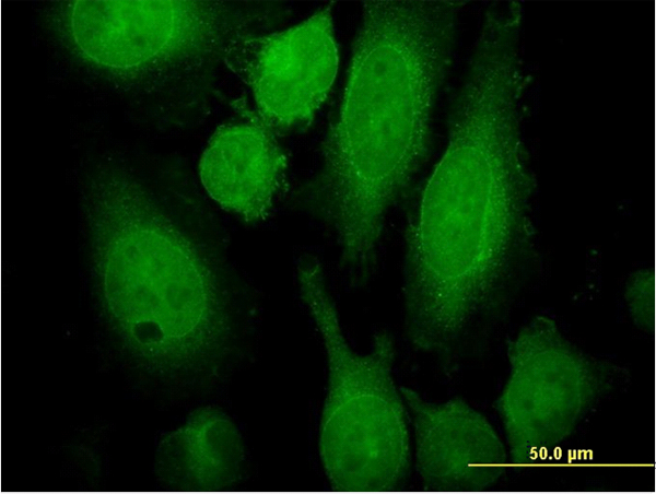 Immunofluorescence of monoclonal antibody to RAB3A on HeLa cell. [antibody concentration 25 ug/ml]