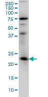 RAB3A monoclonal antibody (M01), clone 4H7 Western Blot analysis of RAB3A expression in IMR-32.
