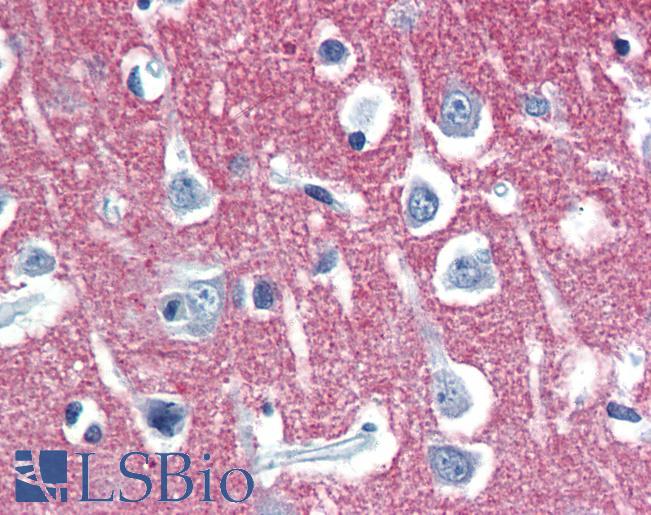 Anti-RAB3A antibody IHC of human brain, cortex. Immunohistochemistry of formalin-fixed, paraffin-embedded tissue after heat-induced antigen retrieval. Antibody LS-B3406 concentration 10 ug/ml.