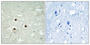 IHC of paraffin-embedded human brain tissue, using RAB3IP Antibody. The picture on the right is treated with the synthesized peptide.