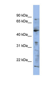 RAB3IP antibody LS-C111504 Western blot of NCI-H226 cell lysate.
