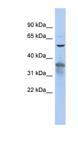 RAB3IP antibody LS-C111503 Western blot of 293T cell lysate.