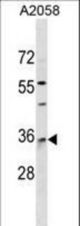 RAB40A Antibody western blot of A2058 cell line lysates (35 ug/lane). The RAB40A antibody detected the RAB40A protein (arrow).