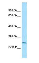RAB5A / RAB5 antibody Western Blot of Mouse Small Intestine.