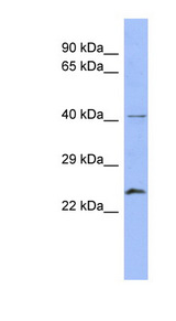 RAB5B antibody LS-C111932 Western blot of Placenta lysate.