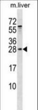 RAB5B Antibody western blot of mouse liver tissue lysates (35 ug/lane). The RAB5B antibody detected the RAB5B protein (arrow).