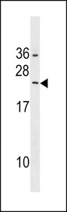 RAB5B Antibody western blot of HepG2 cell line lysates (35 ug/lane). The RAB5B antibody detected the RAB5B protein (arrow).