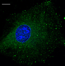 Immunofluorescence. Anti-Rab5b antibody using B6-RPE07 cells at 1:100 dilution.