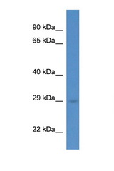 RAB5C antibody LS-C135471 Western blot of Mouse Pancreas lysate. Antibody concentration 1 ug/ml.