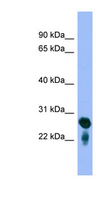 RAB5C antibody LS-C117243 Western blot of Fetal Brain lysate.