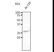 Anti-Rab5c Antibody at 1:500 dilution. Lysates at 100 ug per lane. Rabbit polyclonal to goat Ig (HRP) at 1:10000 dilution.
